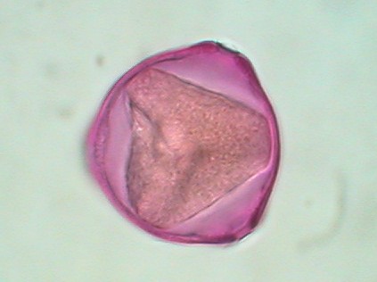 Casuarina equisitifolia - polline